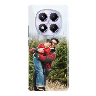 Skal Xiaomi Redmi Note 14 Pro 4g Anpassningsbar